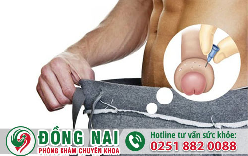 Bao quy đầu phồng rộp – Nam giới không được chủ quan