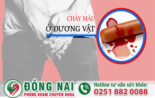 Dương Vật Chảy Máu Bất Thường Cảnh Báo Bệnh Lý Nguy Hiểm