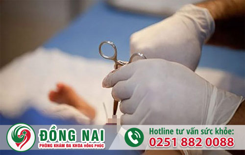 Bao quy đầu bình thường là như thế nào?