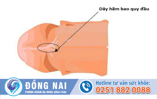 Bao quy đầu chảy máu