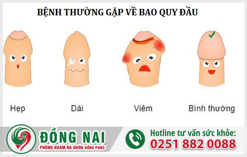 Các bệnh về bao quy đầu