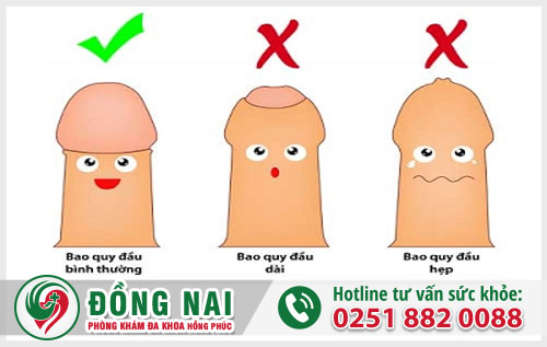 Điều trị các trường hợp dài hẹp và viêm bao quy đầu như thế nào?