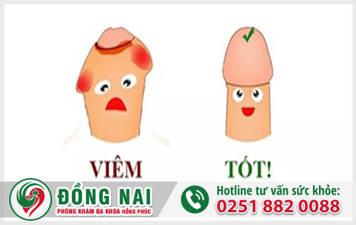 Điều trị các trường hợp dài hẹp và viêm bao quy đầu như thế nào?
