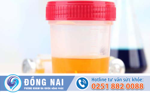 Một số dấu hiệu viêm đường tiết niệu phổ biến