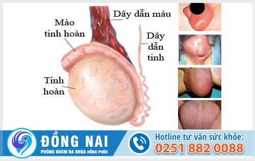 Dấu hiệu nhận biết bạn đang bị đau tinh hoàn