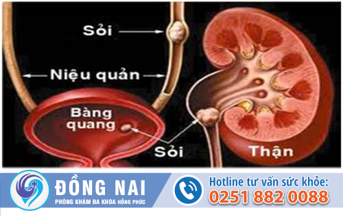 Điều trị tiểu buốt tiểu đau