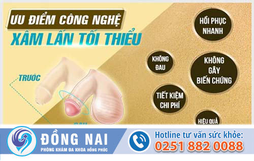 Điều trị xuất tinh sớm hiệu quả