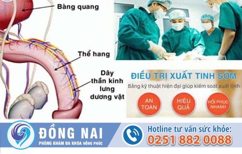 Điều trị xuất tinh sớm hiệu quả