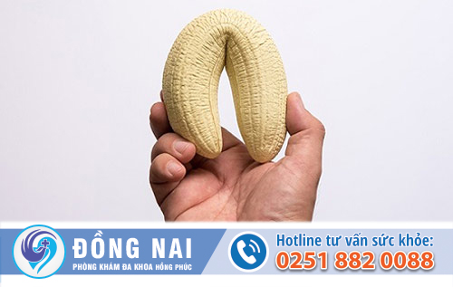 Gãy dương vật là gì?