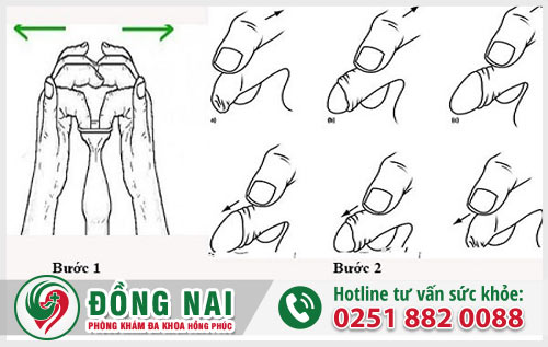 Phương pháp dùng tay lột bao quy đầu