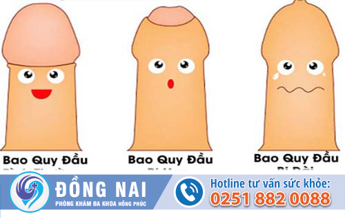 Những ảnh hưởng của dài hẹp bao quy đầu nếu không cắt