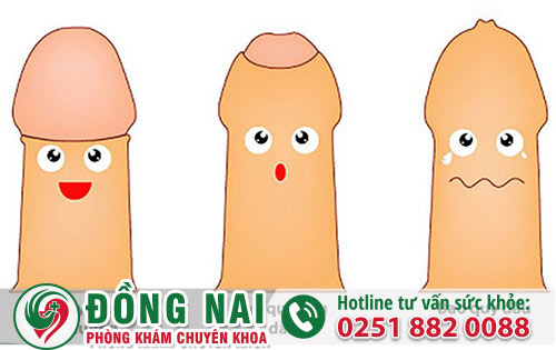 Những Căn Bệnh Ở Đầu Khấc Dương Vật Thường Gặp?