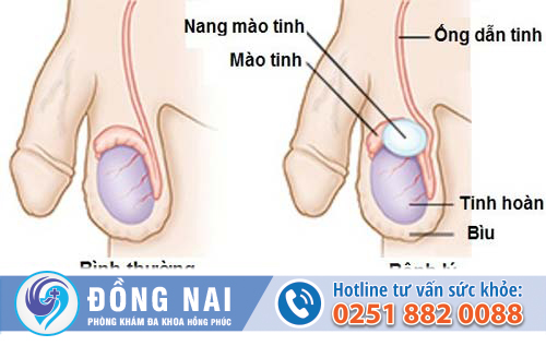 Nổi cục ở tinh hoàn có nguy hiểm không?