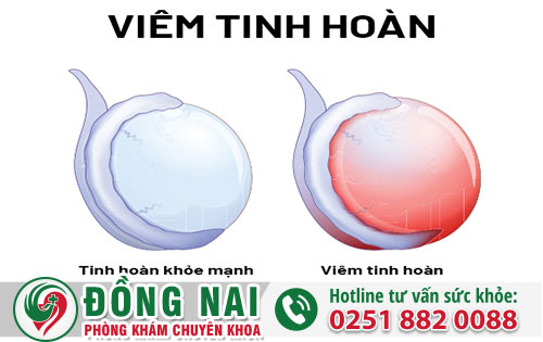 Nổi Mụn Ở Tinh Hoàn