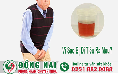 Vì Sao Bị Đi Tiểu Ra Máu?