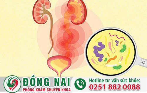 Tiểu Rát Là Bệnh Gì- Phương Pháp Điều Trị Hiệu Quả?