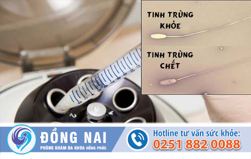 Tinh trùng chết khi nào