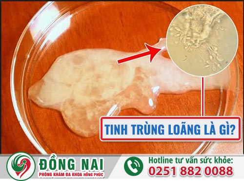 Tinh trùng loãng là gì? Có bị vô sinh không?