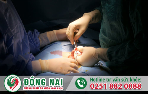 Những trường hợp nào nên cắt bao quy đầu