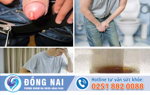 Viêm đường tiết niệu là gì?